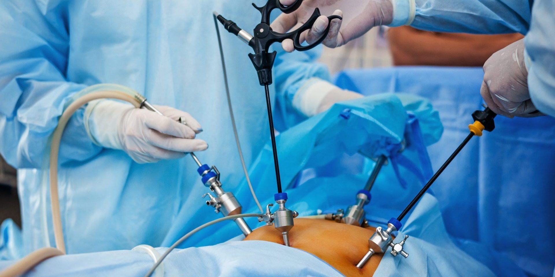 Laparoscopic Hysterectomy